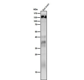 Western blot analysis of Delta 2 Catenin expression in rat brain cell lysate using CTNND2 antibody. 