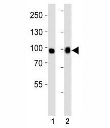 Fibroblast Growth Factor Receptor 3 Antibody (FGFR3)