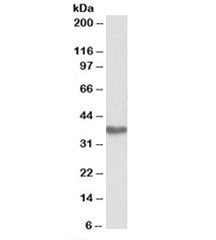 Western blot testing of human placenta lysate with GNA12 antibody at 1ug/ml. Predicted/observed mole