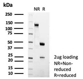 SDS-PAGE analysis of purified, BSA-free FCER2 antibody (clone FCER2/6474R) as confirmation of integr