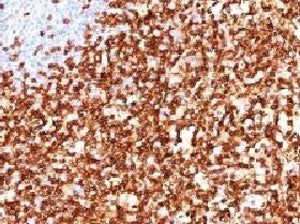 IHC testing of FFPE human tonsil and CD45RO antibody (clone CDLA45RO-1). HIER: boil in pH6 10mM citr