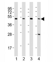 Western blot testing of CTBP1 antibody at 1:2000 dilution. Lane 1: HepG2 lysate; 2: SH-SY5Y lysate; 