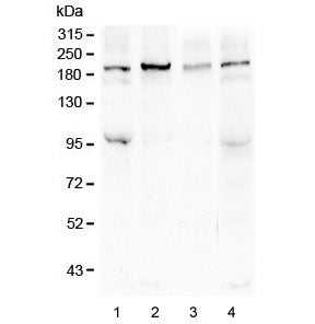 Western blot testing of human 1) HeLa, 2) COLO-320, 3) SHG-44 and 4) HEK293 lysate with Sucrase Isom