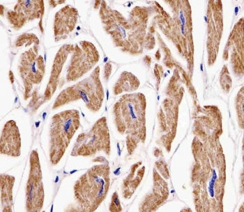 IHC testing of FFPE human heart tissue with MKRN2 antibody. HIER: steam section in pH6 citrate buffe