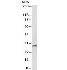 Western blot testing of human spleen lysate with Proteinase 3 antibody at 2ug/ml. Predicted molecula
