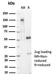 EpCAM Antibody