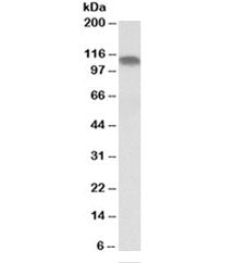 Western blot testing of human skeletal muscle lysate with PGC1A antibody at 0.1ug/ml. Predicted mole