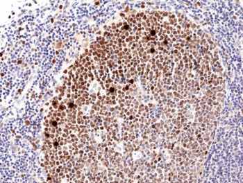 Ki67 Antibody