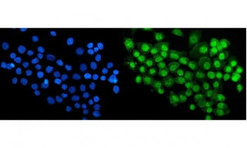 Immunofluorescent staining of FFPE human A431 cells with RBM47 antibody (green) and DAPI nuclear sta