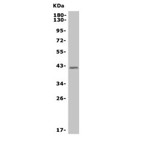 MURF1 Antibody / TRIM63