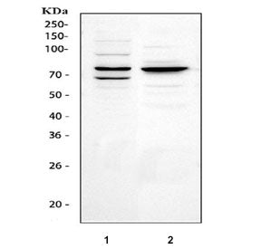 Western blot testing of 1) human HEL and 2) rat kidney tissue lysate with Tec antibody. Predicted mo