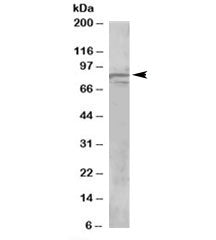 Western blot testing of human brain lysate with OSBPL11 antibody at 1ug/ml. Predicted molecular weig