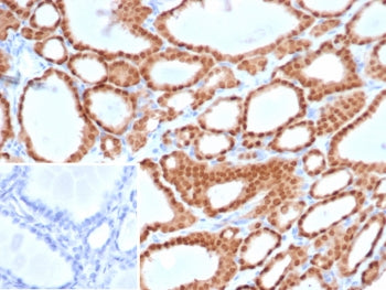 IHC staining of FFPE human thyroid tissue with Paired box protein Pax-8 antibody (clone PAX8/6848R).