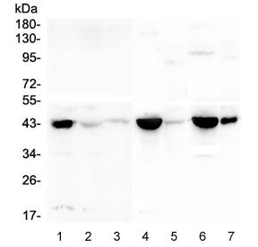 Western blot testing of 1) human K562, 2) human CNE, 3) human COLO-320, 4) rat heart, 5) rat lung, 6