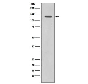 Western blot testing of human HeLa cell lysate with Rad21 antibody. Expected molecular weight: ~120 