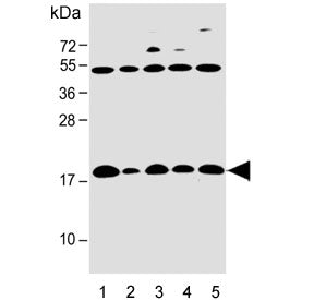 IFITM5 Antibody