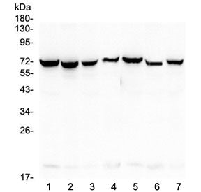 Western blot testing of human 1) HeLa, 2) COLO-320, 3) SW620, 4) A431, 5) A549, 6) HepG2 and 7) PANC