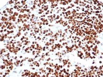 p53 Antibody / TP53