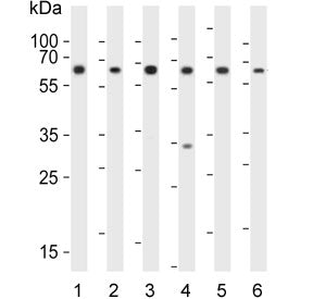 Western blot testing of human 1) K562, 2) Jurkat, 3) HL60, 4) HepG2, 5) kidney and 6) placenta lysat