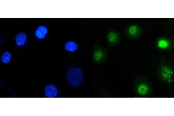 Immunofluorescent staining of FFPE human A549 cells with ARID1A antibody (green) and DAPI nuclear st