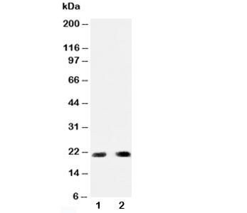 Western blot testing of PUMA antibody and Lane 1: HeLa; 2: rat kidney; Predicted molecular weight: 2