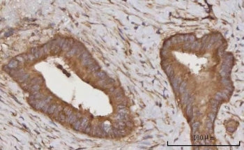 CCL23 Antibody / C-C motif chemokine 23 / MPIF-1