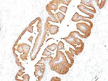 PSA / Prostate Specific Antigen Antibody