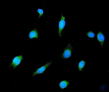 Immunofluorescent staining of FFPE human HeLa cells with GAD2 antibody (green) and DAPI nuclear stai