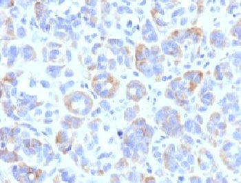 TRP1 / Tyrosinase-Related Protein-1 Antibody