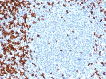 IHC staining of FFPE human tonsil tissue with recombinant CD7 antibody (clone CD7/6388R). HIER: boil tissue sections in pH 9 10mM Tris with 1mM EDTA for 20 min and allow to cool before testing.