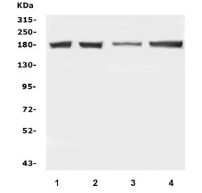 Western blot testing of human 1) U-87 MG, 2) U-2 OS, 3) A431 and 4) A549 cell lysate with DCC antibo