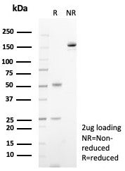 CD23 Antibody