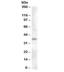 Western blot testing of human adrenal gland lysate with Proenkephalin antibody at 0.3ug/ml. Predicte