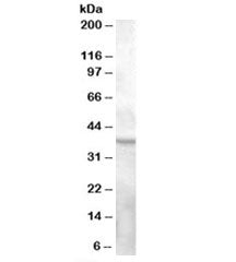 Western blot testing of human ovay lysate with GPR119 antibody at 0.3ug/ml. Predicted molecular weig