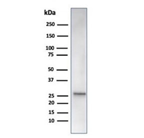 HSP27 Antibody / HSPB1
