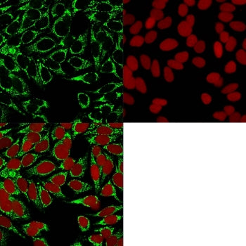 HIF1A Antibody / HIF-1 alpha