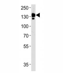 Ceruloplasmin Antibody