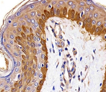 IHC testing of FFPE human skin tissue with S100A2 antibody. HIER: steam section in pH6 citrate buffe