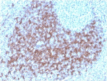 IHC staining of FFPE human tonsil with biotin-labeled CD23 antibody (clone FCER2/3592). HIER: boil t