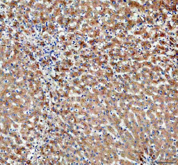 Immunohistochemical staining of PDZK1 using anti-PDZK1 antibody. PDZK1 was detected in a paraffin-em