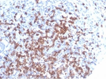 CD8A Antibody