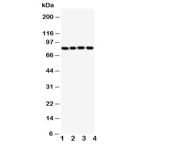 Western blot testing of SP4 antibody and Lane 1: rat spleen; and human samples 2: SGC; 3: HeLa; 4: J