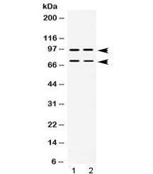 PML Antibody / Promyelocytic leukemia protein