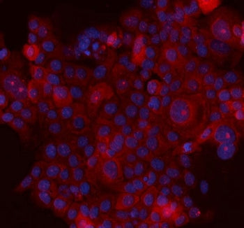 Immunofluorescent staining of FFPE human A431 cells with SERPINB5 antibody (red) and DAPI nuclear st