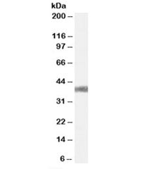 Western blot testing of mouse liver lysate with AGTR1 antibody at 0.3ug/ml. Observed molecular weigh