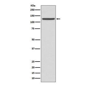 Western blot testing of human fetal liver lysate with CD41 antibody. Expected molecular weight ~120 