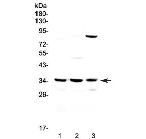 Western blot testing of 1) rat liver, 2) mouse liver and 3) mouse NIH3T3 lysate with Bikunin antibod