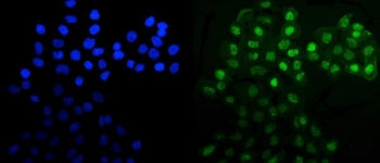 Immunofluorescent staining of FFPE human A431 cells with MNAT1 antibody (green) and DAPI nuclear sta