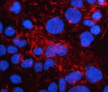 LAD1 Antibody / Ladinin 1