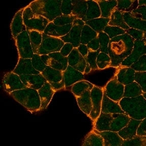 Immunofluorescent staining of PFA-fixed human MCF-7 cells using PRMT6 antibody (green, clone PCRP-PR